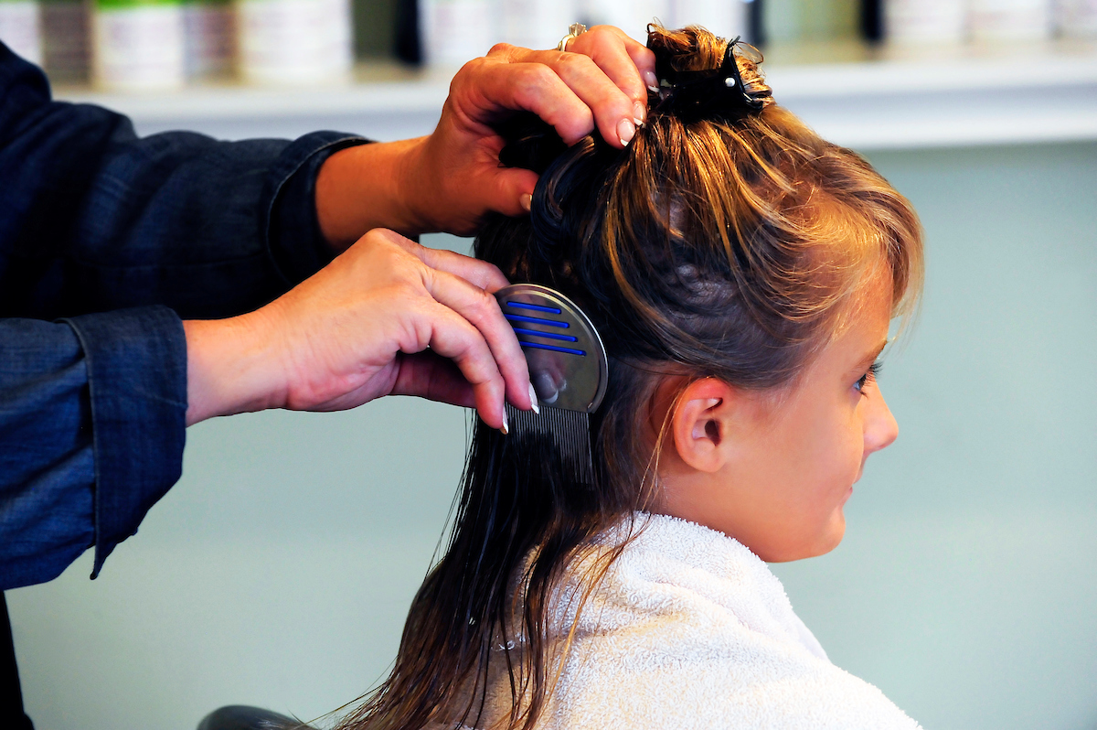 Mild vs Severe Lice Infestation: Why it Makes a Difference